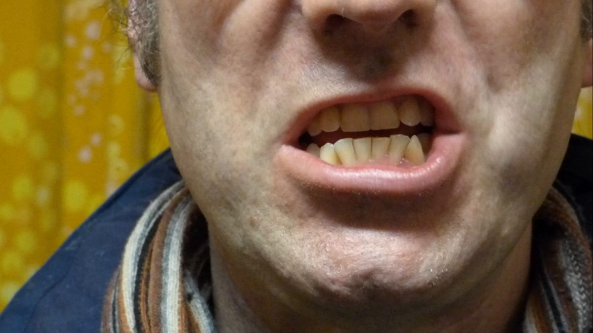 Joergundtoene – Neues Video